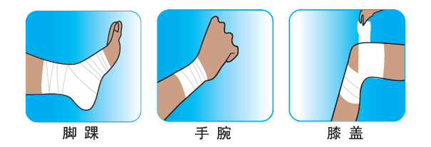 醫(yī)用外固定帶(圖1)